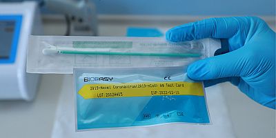 Koronavirüs Testi 15 Dakikada Çıkacak